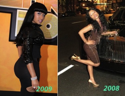 Nicki-Minaj-Booty-Implants-500x385.jpg