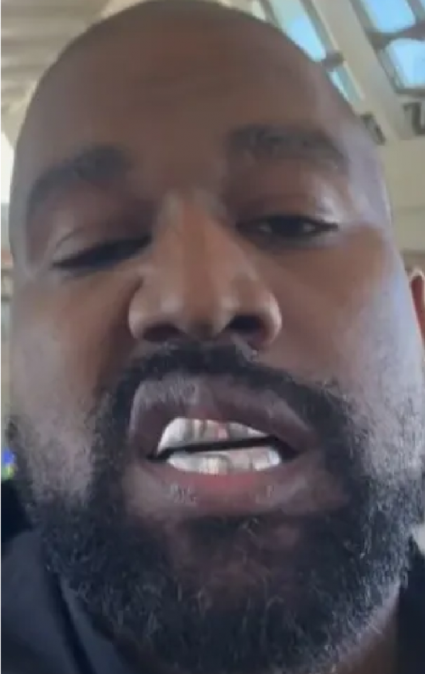 why-does-cowboys-teeth-looks-like-kanye-wests-grills-teeth-v0-aylv18nxhimd1.png