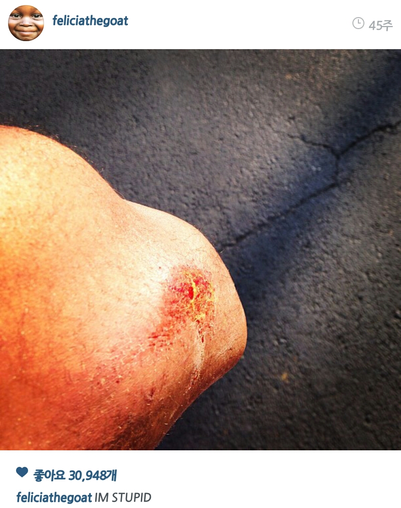 PicsArt_1407650649168.jpg : 약혐)타일러 이새키는 하루라도 안다치는날이 없어