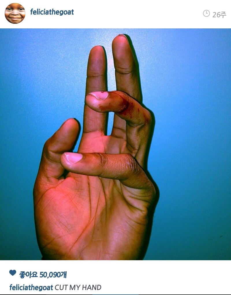 PicsArt_1407650501901.jpg : 약혐)타일러 이새키는 하루라도 안다치는날이 없어