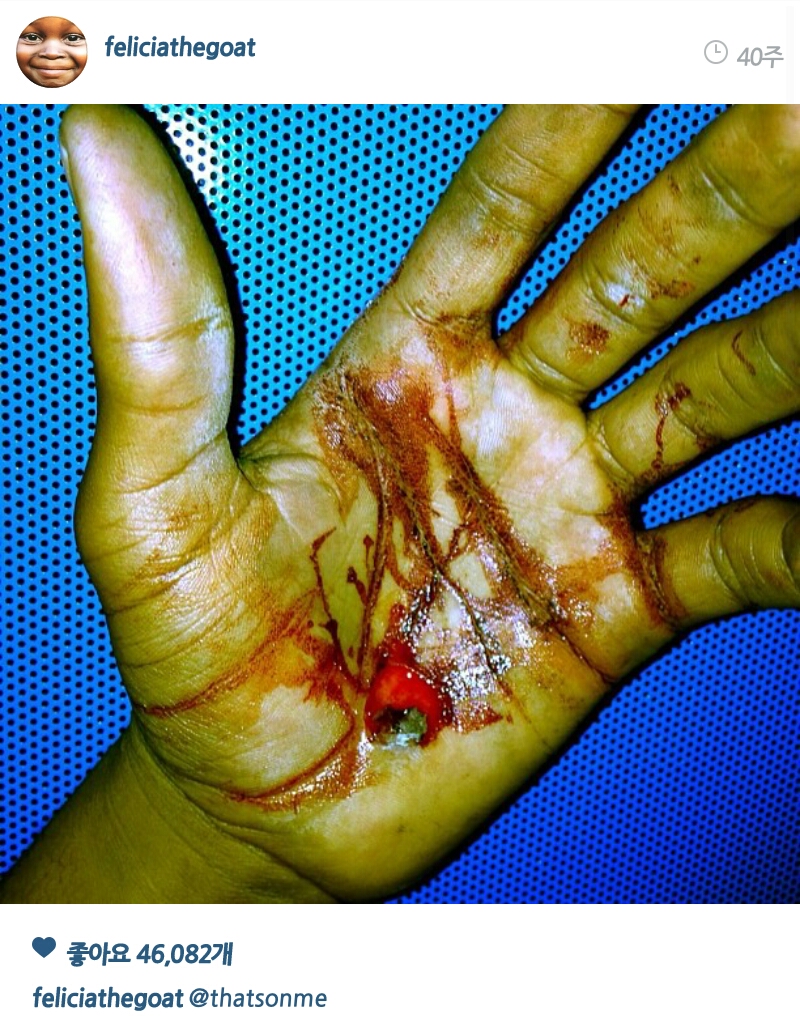 PicsArt_1407650569993.jpg : 약혐)타일러 이새키는 하루라도 안다치는날이 없어