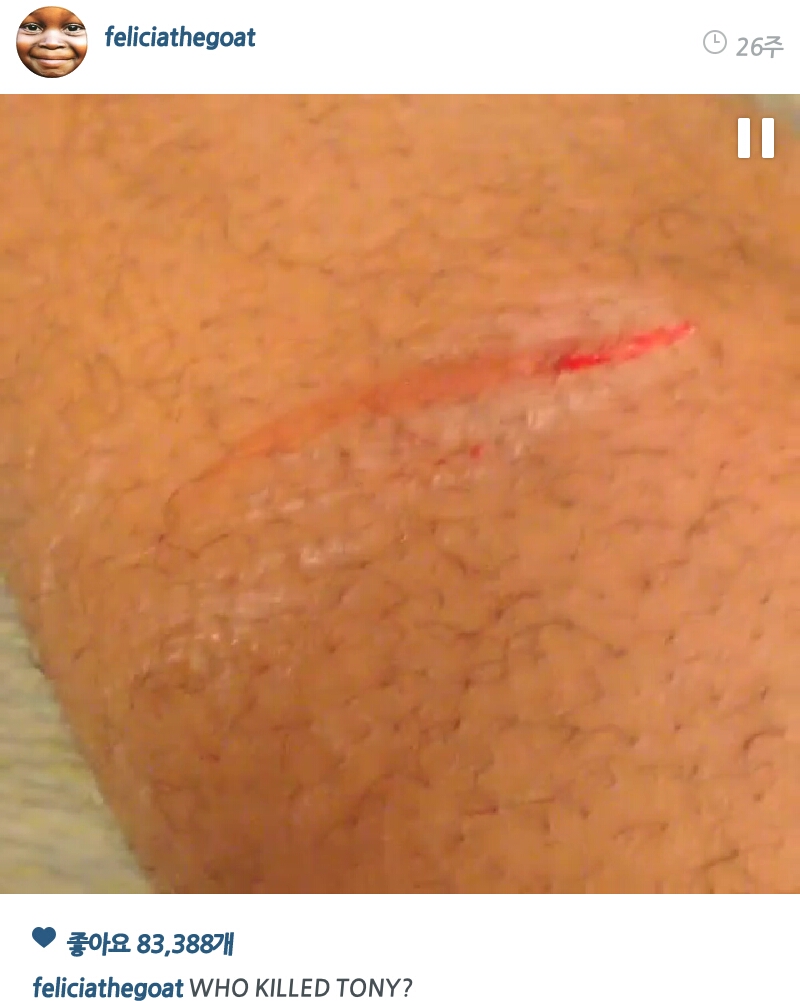 PicsArt_1407650536207.jpg : 약혐)타일러 이새키는 하루라도 안다치는날이 없어