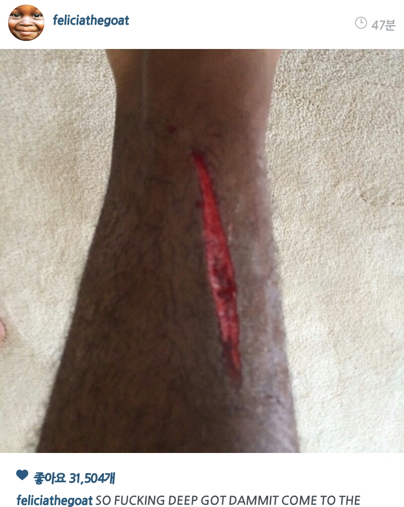 PicsArt_1407651413528.jpg : 약혐)타일러 이새키는 하루라도 안다치는날이 없어