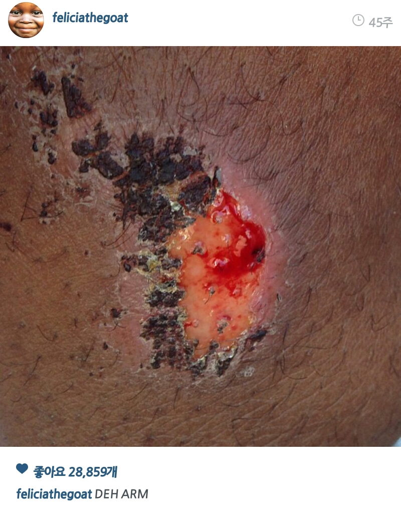 PicsArt_1407650615046.jpg : 약혐)타일러 이새키는 하루라도 안다치는날이 없어