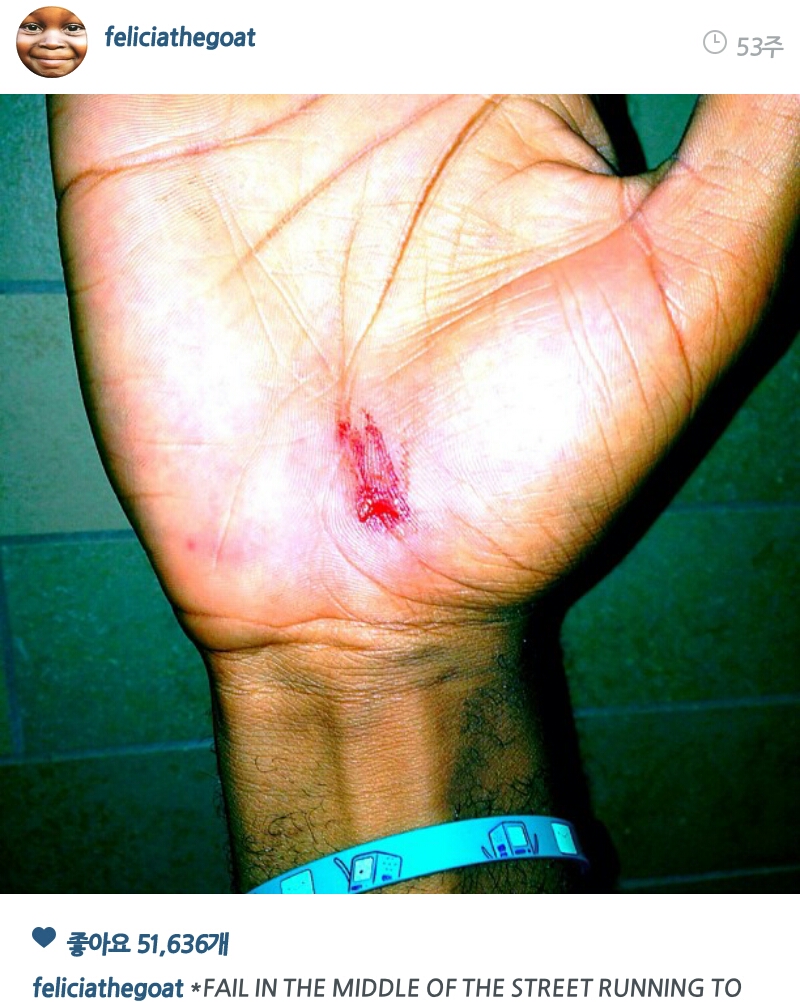 PicsArt_1407650703773.jpg : 약혐)타일러 이새키는 하루라도 안다치는날이 없어