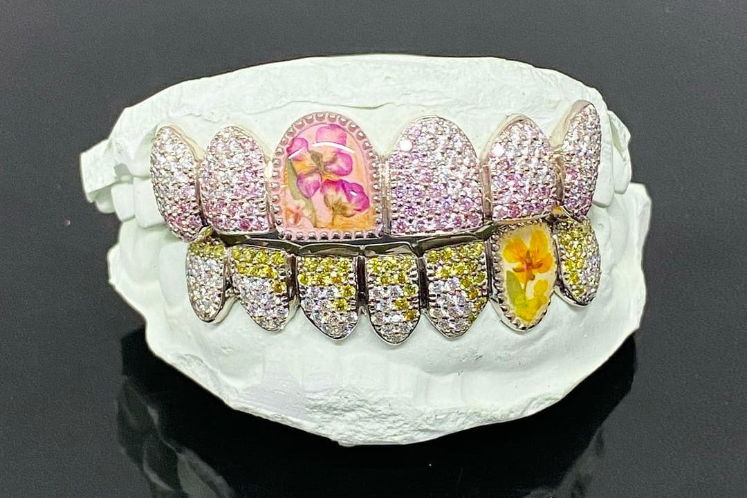 asap-rocky-new-real-flowers-grillz-jewelz-photos-001.jpg